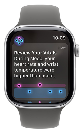 Apple Watch-skjerm som viser varselet «Review Your Vitals»